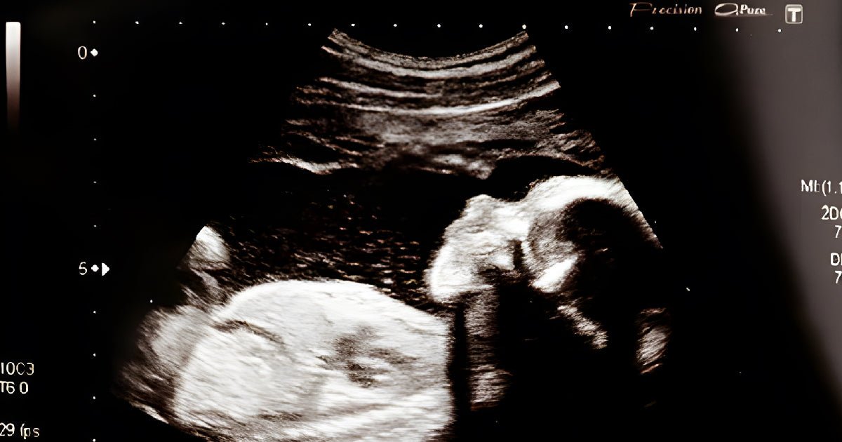 Your Skincare Product May Cause Birth Defects! - Picket&Rail Furniture, Art & Baby Family Store